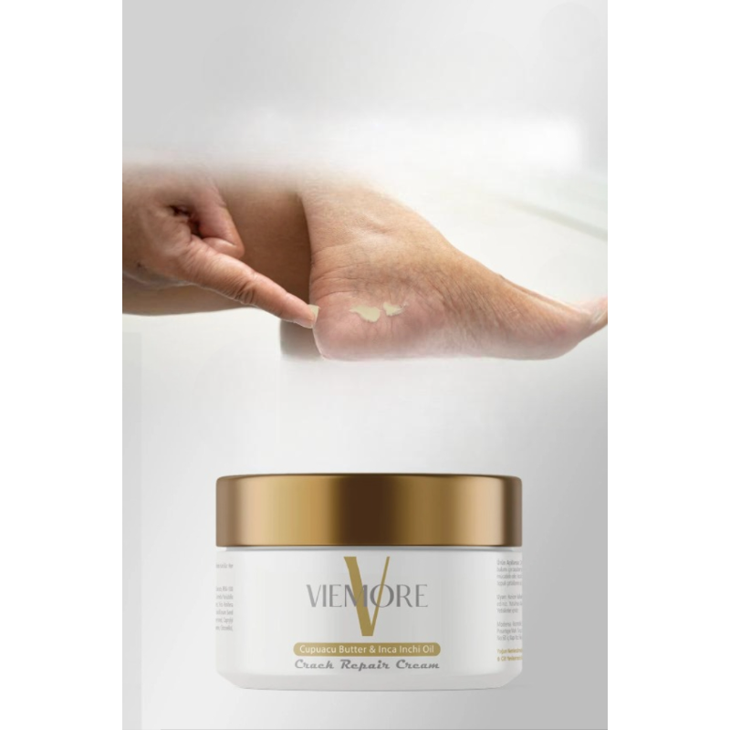 Viemore Hiel- & Voetcrème 100ml - Tegen Hielkloven en Droge Voeten