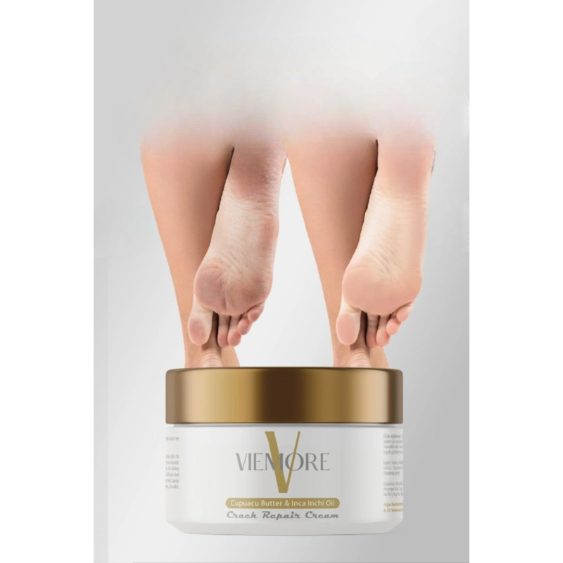 Viemore Hiel- & Voetcrème 100ml - Tegen Hielkloven en Droge Voeten